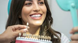 Enhance Your Smile with a Trusted Cosmetic Dentist in Rockville, MD
